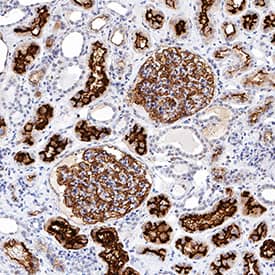 Neprilysin/CD10 was detected in immersion fixed paraffin-embedded sections of human kidney using Mouse Anti-Human Neprilysin/CD10 Monoclonal Antibody (Catalog # MAB11821) at 0.5 µg/mL for 1 hour at room temperature followed by incubation with the Anti-Mouse IgG VisUCyte™ HRP Polymer Antibody (Catalog # VC001). Tissue was stained using DAB (brown) and counterstained with hematoxylin (blue). Specific staining was localized to convoluted tubules and glomeruli. View our protocol for IHC Staining with VisUCyte HRP Polymer Detection Reagents.
