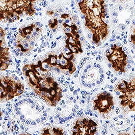 Neprilysin/CD10 was detected in immersion fixed paraffin-embedded sections of human kidney using Mouse Anti-Human Neprilysin/CD10 Monoclonal Antibody (Catalog # MAB11822) at 0.5 µg/mL for 1 hour at room temperature followed by incubation with the Anti-Mouse IgG VisUCyte™ HRP Polymer Antibody (Catalog # VC001). Before incubation with the primary antibody, tissue was subjected to heat-induced epitope retrieval using Antigen Retrieval Reagent-Basic (Catalog # CTS013). Tissue was stained using DAB (brown) and counterstained with hematoxylin (blue). Specific staining was localized to cell surface in epithelial cells. View our protocol for IHC Staining with VisUCyte HRP Polymer Detection Reagents.