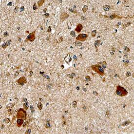 Nesfatin-1/Nucleobindin-2 was detected in immersion fixed paraffin-embedded sections of human brain (hypothalamus) using Sheep Anti-Human Nesfatin-1/Nucleobindin-2 Antigen Affinity-purified Polyclonal Antibody (Catalog # AF5949) at 15 µg/mL overnight at 4 °C. Tissue was stained using the Anti-Sheep HRP-DAB Cell & Tissue Staining Kit (brown; Catalog # CTS019) and counterstained with hematoxylin (blue). Specific staining was localized to neuronal cell bodies. View our protocol for Chromogenic IHC Staining of Paraffin-embedded Tissue Sections.