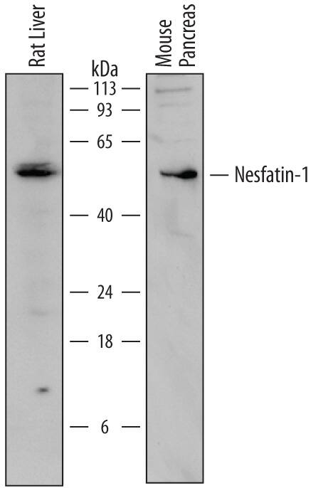 Western Blot Nesfatin-1/Nucleobindin-2 Antibody [Unconjugated]