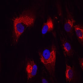 Nesfatin-1/Nucleobindin-2 was detected in immersion fixed human mesenchymal stem cells differentiated into adipocytes using Sheep Anti-Human Nesfatin-1/Nucleobindin-2 Antigen Affinity-purified Polyclonal Antibody (Catalog # AF5949) at 10 µg/mL for 3 hours at room temperature. Cells were stained using the NorthernLights™ 557-conjugated Anti-Sheep IgG Secondary Antibody (red; Catalog # NL010) and counterstained with DAPI (blue). Specific staining was localized to Golgi. View our protocol for Fluorescent ICC Staining of Stem Cells on Coverslips.