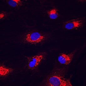 Nesfatin-1/Nucleobindin-2 was detected in immersion fixed human mesenchymal stem cells differentiated into adipocytes using Rat Anti-Human Nesfatin-1/Nucleobindin-2 Monoclonal Antibody (Catalog # MAB5949) at 10 µg/mL for 3 hours at room temperature. Cells were stained using the NorthernLights™ 557-conjugated Anti-Rat IgG Secondary Antibody (red; Catalog # NL013) and counterstained with DAPI (blue). Specific staining was localized to Golgi. View our protocol for Fluorescent ICC Staining of Stem Cells on Coverslips.