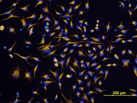 Nestin was detected in immersion fixed rat cortical stem cells using Goat Anti-Rat Nestin Antigen Affinity-purified Polyclonal Antibody (Catalog # AF2736) at 10 µg/mL for 3 hours at room temperature. Cells were stained using the NorthernLights™ 557-conjugated Anti-Goat IgG Secondary Antibody (yellow; Catalog # NL001) and counterstained with DAPI (blue). View our protocol for Fluorescent ICC Staining of Cells on Coverslips.