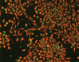 Nestin was detected in immersion fixed rat cortical stem cells using 10 µg/mL Goat Anti-Rat Nestin Antigen Affinity-purified Polyclonal Antibody (Catalog # AF2736) for 3 hours at room temperature. Cells were stained with the NorthernLights™ 557-conjugated Anti-Goat IgG Secondary Antibody (red; Catalog # NL001) and counterstained (green). View our protocol for Fluorescent ICC Staining of Cells on Coverslips.