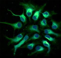 Nestin was detected in immersion fixed human fetal neural progenitor cells using 10 &micro;g/mL Human Nestin Monoclonal Antibody (Catalog # MAB1259) for 3 hours at room temperature. Cells were stained (green) and counterstained with DAPI (blue). View our protocol for Fluorescent ICC Staining of Cells on Coverslips.