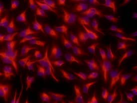 Nestin was detected in immersion fixed undifferentiated rat cortical stem cells using Mouse Anti-Rat Nestin Monoclonal Antibody (Catalog # MAB2736) at 10 µg/mL for 3 hours at room temperature. Cells were stained using the NorthernLights™ 557-conjugated Anti-Mouse IgG Secondary Antibody (red; Catalog # NL007) and counterstained with DAPI (blue). View our protocol for Fluorescent ICC Staining of Cells on Coverslips.