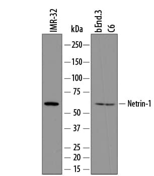 Western blot shows lysates of IMR-32 human neuroblastoma cell line, bEnd.3 mouse endothelioma cell line, and C6 rat glioma cell line. PVDF membrane was probed with 0.5 µg/mL of Sheep Anti-Human/Mouse/Rat Netrin-1 Antigen Affinity-purified Polyclonal Antibody (Catalog # AF6419) followed by HRP-conjugated Anti-Sheep IgG Secondary Antibody (Catalog # HAF016). A specific band was detected for Netrin-1 at approximately 66 kDa (as indicated). This experiment was conducted under reducing conditions and using Immunoblot Buffer Group 8.