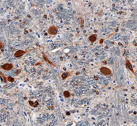 Immunohistochemistry Neudesin Antibody (737130)