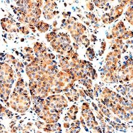 NRG1-beta 1/HRG1-beta 1 was detected in immersion fixed paraffin-embedded sections of human breast using Goat Anti-Human NRG1-beta 1/HRG1-beta 1 EGF Domain Antigen Affinity-purified Polyclonal Antibody (Catalog # AF-396-NA) at 1 µg/mL overnight at 4 °C. Tissue was stained using the Anti-Goat HRP-DAB Cell & Tissue Staining Kit (brown; Catalog # CTS008) and counterstained with hematoxylin (blue). Specific staining was localized to cytoplasm. View our protocol for Chromogenic IHC Staining of Paraffin-embedded Tissue Sections.