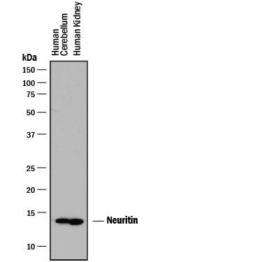 Western blot shows lysates of human brain (cerebellum) tissue and human kidney tissue. PVDF membrane was probed with 1 µg/mL of Goat Anti-Human/Rat Neuritin Antigen Affinity-purified Polyclonal Antibody (Catalog # AF283) followed by HRP-conjugated Anti-Goat IgG Secondary Antibody (Catalog # HAF017). A specific band was detected for Neuritin at approximately 14 kDa (as indicated). This experiment was conducted under reducing conditions and using Immunoblot Buffer Group 1.