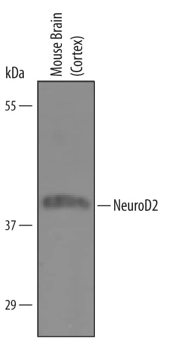 Western Blot NeuroD2 Antibody