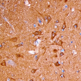 Neurocan was detected in immersion fixed paraffin-embedded sections of human brain using Sheep Anti-Human Neurocan Antigen Affinity-purified Polyclonal Antibody (Catalog # AF6508) at 1.7 µg/mL overnight at 4 °C. Tissue was stained using the Anti-Sheep HRP-DAB Cell & Tissue Staining Kit (brown; Catalog # CTS019) and counter-stained with hematoxylin (blue). Specific staining was localized to the cytoplasm of neurons. View our protocol for Chromogenic IHC Staining of Paraffin-embedded Tissue Sections.