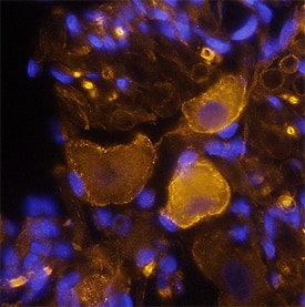 Immunohistochemistry Neurofascin Antibody
