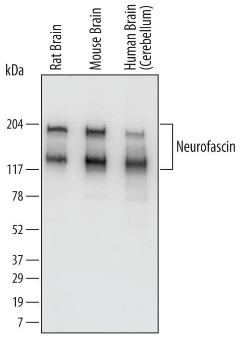 Western blot shows lysates of rat brain tissue, mouse brain tissue, and human brain (cerebellum). PVDF Membrane was probed with 0.1 µg/mL of Chicken Anti-Human/Mouse/Rat Neurofascin Antigen Affinity-purified Polyclonal Antibody (Catalog # AF3235) followed by HRP-conjugated Anti-Chicken IgY Secondary Antibody. Specific bands were detected for Neurofascin at approximately 140 and186 kDa (as indicated). This experiment was conducted under reducing conditions and using Immunoblot Buffer Group 1.