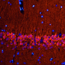 Neurogranin was detected in perfusion fixed frozen sections of rat brain (hippocampus) using Sheep Anti-Human/Mouse/Rat Neurogranin Antigen Affinity-purified Polyclonal Antibody (Catalog # AF7947) at 0.5 µg/mL overnight at 4 °C. Tissue was stained using the NorthernLights™ 557-conjugated Anti-Sheep IgG Secondary Antibody (red; NL010) and counterstained with DAPI (blue). Specific staining was localized to pyramidal neurons in the hippocampus. View our protocol for Fluorescent IHC Staining of Frozen Tissue Sections.
