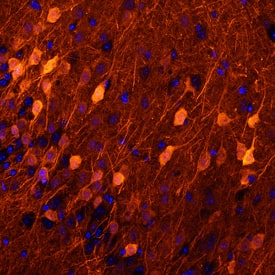 Neurogranin was detected in perfusion fixed frozen sections of mouse brain using Mouse Anti-Human/Mouse/Rat Neurogranin Monoclonal Antibody (Catalog # MAB7947) at 25 µg/mL overnight at 4 °C. Tissue was stained using the NorthernLights™ 557-conjugated Anti-Mouse IgG Secondary Antibody (red; Catalog # NL007) and counterstained with DAPI (blue). Specific staining was localized to cytoplasm in neurons. View our protocol for Fluorescent IHC Staining of Frozen Tissue Sections.