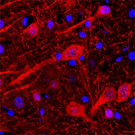 Immunohistochemistry Neuroligin 1/NLGN1 Antibody