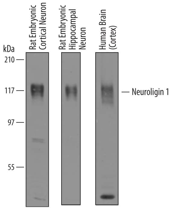 Western Blot Neuroligin 1/NLGN1 Antibody
