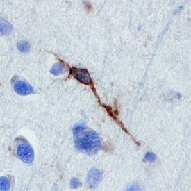 Immunohistochemistry Neuroligin 4X/NLGN4X Antibody [Unconjugated]