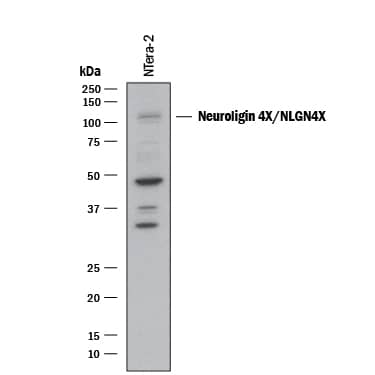 Western Blot Neuroligin 4X/NLGN4X Antibody [Unconjugated]