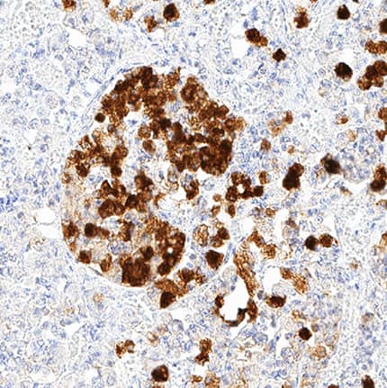 Immunohistochemistry Neuronal Pentraxin 2 Antibody (569703) [Unconjugated]