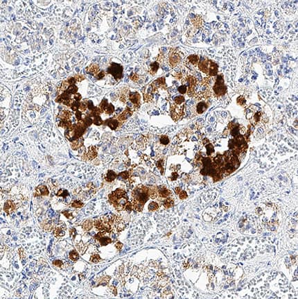 Neuronal Pentraxin 2 was detected in immersion fixed paraffin-embedded sections of human pancreas tissue using Mouse Anti-Human Neuronal Pentraxin 2 Monoclonal Antibody (Catalog # MAB7816) at 5 µg/mL for 1 hour at room temperature followed by incubation with the Anti-Mouse IgG VisUCyte™ HRP Polymer Antibody (Catalog # VC001). Before incubation with the primary antibody, tissue was subjected to heat-induced epitope retrieval using Antigen Retrieval Reagent-Basic (Catalog # CTS013). Tissue was stained using DAB (brown) and counterstained with hematoxylin (blue). Specific staining was localized to cytoplasm of pancreatic islets. View our protocol for IHC Staining with VisUCyte HRP Polymer Detection Reagents.