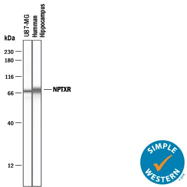 Simple Western lane view shows lysates of U-87 MG human glioblastoma/astrocytoma cell line and human hippocampus tissue, loaded at 0.2 mg/mL. A specific band was detected for Neuronal Pentraxin R/NPTXR at approximately 66 kDa (as indicated) using 20 µg/mL of Sheep Anti-Human Neuronal Pentraxin R/NPTXR Antigen Affinity-purified Polyclonal Antibody (Catalog # AF4414) followed by 1:50 dilution of HRP-conjugated Anti-Sheep IgG Secondary Antibody (HAF016). This experiment was conducted under reducing conditions and using the 12-230 kDa separation system.