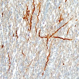 Neuropeptide Y/NPY was detected in immersion fixed paraffin-embedded sections of human brain (hypothalamus) using Mouse Anti-Human Neuropeptide Y/NPY Monoclonal Antibody (Catalog # MAB8517) at 15 µg/mL overnight at 4 °C. Tissue was stained using the Anti-Mouse HRP-DAB Cell & Tissue Staining Kit (brown; Catalog # CTS002) and counterstained with hematoxylin (blue). Specific staining was localized to neuronal processes. View our protocol for Chromogenic IHC Staining of Paraffin-embedded Tissue Sections.