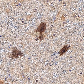 Neurophysin II was detected in immersion fixed paraffin-embedded sections of human brain hippocampus tissue using Mouse Anti-Human Neurophysin II Monoclonal Antibody (Catalog # MAB009) at 5 µg/mL for 1 hour at room temperature followed by incubation with the Anti-Mouse IgG VisUCyte™ HRP Polymer Antibody (Catalog # VC001). Before incubation with the primary antibody, tissue was subjected to heat-induced epitope retrieval using Antigen Retrieval Reagent-Basic (Catalog # CTS013). Tissue was stained using DAB (brown) and counterstained with hematoxylin (blue). Specific staining was localized to neurons. View our protocol for IHC Staining with VisUCyte HRP Polymer Detection Reagents.