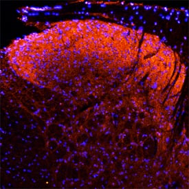 Immunohistochemistry Neuropilin-1 Antibody [Unconjugated]