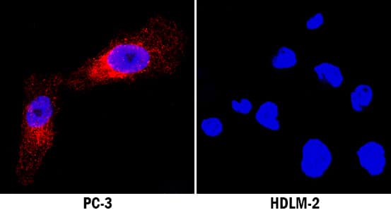 Immunocytochemistry Neuropilin-1 Antibody [Unconjugated]