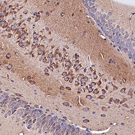 Neuropilin-1 was detected in immersion fixed paraffin-embedded sections of rat brain (hippocampus) using Goat Anti-Mouse/Rat Neuropilin-1 Antigen Affinity-purified Polyclonal Antibody (Catalog # AF566) at 3 µg/mL for 1 hour at room temperature followed by incubation with the Anti-Goat IgG VisUCyte™ HRP Polymer Antibody (Catalog # VC004). Tissue was stained using DAB (brown) and counterstained with hematoxylin (blue). Specific staining was localized to cytoplasm in neuronal cell bodies and projections. View our protocol for IHC Staining with VisUCyte HRP Polymer Detection Reagents.