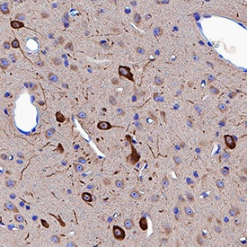 Neuropilin-1 was detected in immersion fixed paraffin-embedded sections of rat brain (thalamus) using Goat Anti-Mouse/Rat Neuropilin-1 Antigen Affinity-purified Polyclonal Antibody (Catalog # AF566) at 3 µg/mL for 1 hour at room temperature followed by incubation with the Anti-Goat IgG VisUCyte™ HRP Polymer Antibody (Catalog # VC004). Tissue was stained using DAB (brown) and counterstained with hematoxylin (blue). Specific staining was localized to cytoplasm in neuronal cell bodies and projections. View our protocol for IHC Staining with VisUCyte HRP Polymer Detection Reagents.