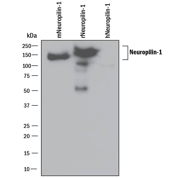 Western blot shows 25 ng of Recombinant Mouse Neuropilin-1 (Catalog # 5994-N1), Recombinant Rat Neuropilin-1 Fc Chimera (Catalog # 566-N1) and Recombinant Human Neuropilin-1 (Catalog # 3870-N1). PVDF Membrane was probed with 0.1 µg/mL of Goat Anti-Mouse/Rat Neuropilin-1 Antigen Affinity-purified Polyclonal Antibody (Catalog # AF566) followed by HRP-conjugated Anti-Goat IgG Secondary Antibody (Catalog # HAF109). A specific band was detected for Neuropilin-1 at approximately 150 kDa (as indicated). This experiment was conducted under reducing conditions and using Immunoblot Buffer Group 1.