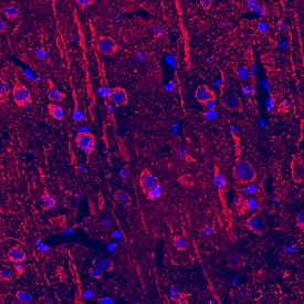 Immunohistochemistry Neuropilin-2 Antibody [Unconjugated]