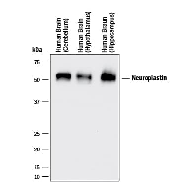 Western Blot Neuroplastin Antibody [Unconjugated]