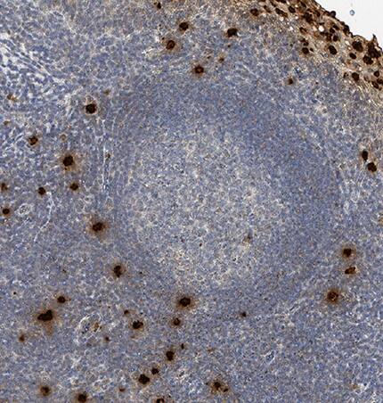 Neutrophil Elastase/ELA2 was detected in immersion fixed paraffin-embedded sections of human tonsil using Mouse Anti-Human Neutrophil Elastase/ELA2 Monoclonal Antibody (Catalog # MAB91671R) at 0.05 µg/mL for 1 hour at room temperature followed by incubation with the Anti-Mouse IgG VisUCyte™ HRP Polymer Antibody (Catalog # VC001). Before incubation with the primary antibody, tissue was subjected to heat-induced epitope retrieval using Antigen Retrieval Reagent-Basic (Catalog # CTS013). Tissue was stained using DAB (brown) and counterstained with hematoxylin (blue). Specific staining was localized to neutrophils. View our protocol for IHC Staining with VisUCyte HRP Polymer Detection Reagents.