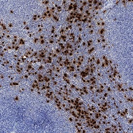 Neutrophil Elastase/ELA2 was detected in immersion fixed paraffin-embedded sections of human lymphoma using Mouse Anti-Human Neutrophil Elastase/ELA2 Monoclonal Antibody (Catalog # MAB91671) at 5 µg/mL for 1 hour at room temperature followed by incubation with the Anti-Mouse IgG VisUCyte™ HRP Polymer Antibody (Catalog # VC001). Tissue was stained using DAB (brown) and counterstained with hematoxylin (blue). Specific staining was localized to cytoplasm. View our protocol for IHC Staining with VisUCyte HRP Polymer Detection Reagents.