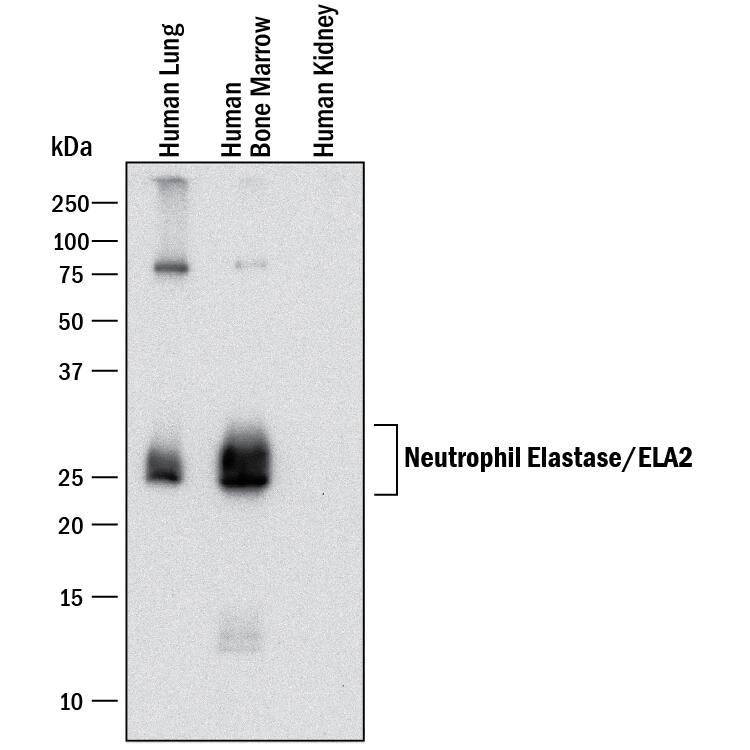 Western blot shows lysates of human lung tissue, human bone marrow, and human kidney tissue (negative control). PVDF membrane was probed with 1 µg/mL of Mouse Anti-Human Neutrophil Elastase/ELA2 Monoclonal Antibody (Catalog # MAB91672) followed by HRP-conjugated Anti-Mouse IgG Secondary Antibody (Catalog # HAF018). Specific bands were detected for Neutrophil Elastase/ELA2 at approximately 25-30 kDa (as indicated). This experiment was conducted under reducing conditions and using Immunoblot Buffer Group 1.