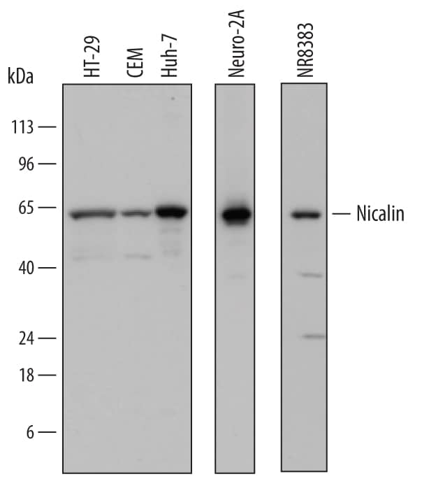 Western blot shows lysates of HT-29 human colon adenocarcinoma cell line, CEM human T-lymphoblastoid cell line, Huh-7 human hepatoma cell line, Neuro-2A mouse neuroblastoma cell line, and NR8383 rat alveolar macrophage cell line. PVDF membrane was probed with 0.5 µg/mL of Sheep Anti-Human/ Mouse/Rat Nicalin Antigen Affinity-purified Polyclonal Antibody (Catalog # AF7686) followed by HRP-conjugated Anti-Sheep IgG Secondary Antibody (Catalog # HAF016). A specific band was detected for Nicalin at approximately 60 kDa (as indicated). This experiment was conducted under reducing conditions and using Immunoblot Buffer Group 1.
