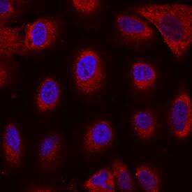 Immunocytochemistry Nicastrin Antibody (716918)