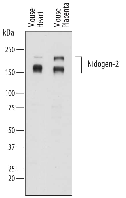 Western blot shows lysates of mouse heart tissue and mouse placenta tissue. PVDF membrane was probed with 0.2 µg/mL of Sheep Anti-Mouse Nidogen-2 Antigen Affinity-purified Polyclonal Antibody (Catalog # AF6760) followed by HRP-conjugated Anti-Sheep IgG Secondary Antibody (Catalog # HAF016). Specific bands were detected for Nidogen-2 at approximately 160-200 kDa (as indicated). This experiment was conducted under reducing conditions and using Immunoblot Buffer Group 1.
