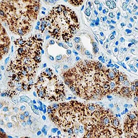 Niemann-Pick Type C2/NPC2 was detected in immersion fixed paraffin-embedded sections of human kidney using Rabbit Anti-Human Niemann-Pick Type C2/NPC2 Antigen Affinity-purified Polyclonal Antibody (Catalog # AF8644) at 1:50 dilution overnight at 4 °C. Tissue was stained using the Anti-Rabbit HRP-DAB Cell & Tissue Staining Kit (brown; Catalog # CTS005) and counterstained with hematoxylin (blue). Specific staining was localized to cytoplasm in tubular epithelial cells. View our protocol for Chromogenic IHC Staining of Paraffin-embedded Tissue Sections.