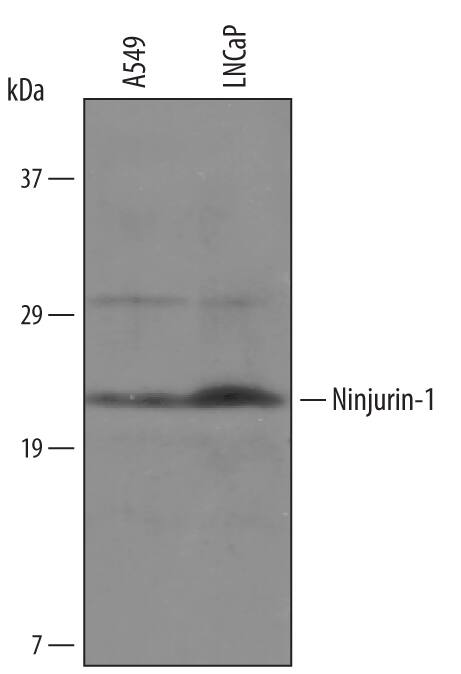Western blot shows lysates of A549 human lung carcinoma cell line and LNCaP human prostate cancer cell line. PVDF membrane was probed with 1 µg/mL of Sheep Anti-Human Ninjurin-1 Biotinylated Antigen Affinity-purified Polyclonal Antibody (Catalog # BAF5105) followed by HRP-conjugated Anti-Sheep IgG Secondary Antibody (Catalog # HAF016). A specific band was detected for Ninjurin-1 at approximately 20 kDa (as indicated). This experiment was conducted under reducing conditions and using Immunoblot Buffer Group 1.