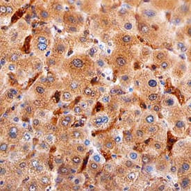 Ninjurin-1 was detected in immersion fixed paraffin-embedded sections of human liver using Mouse Anti-Human Ninjurin-1 Monoclonal Antibody (Catalog # MAB51051) at 15 µg/mL overnight at 4 °C. Before incubation with the primary antibody, tissue was subjected to heat-induced epitope retrieval using Antigen Retrieval Reagent-Basic (Catalog # CTS013). Tissue was stained using the Anti-Mouse HRP-DAB Cell & Tissue Staining Kit (brown; Catalog # CTS002) and counterstained with hematoxylin (blue). Specific staining was localized to Kupffer cells. View our protocol for Chromogenic IHC Staining of Paraffin-embedded Tissue Sections.