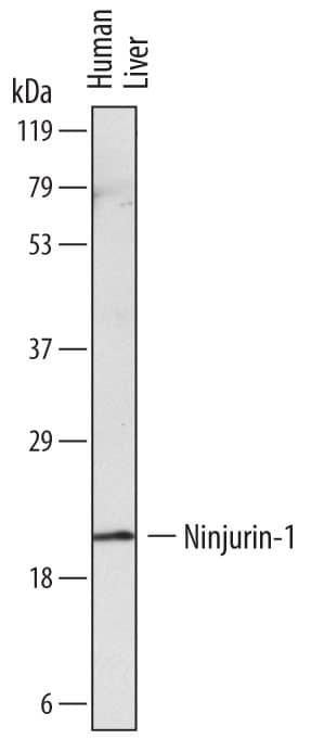Western blot shows lysates of human liver tissue. PVDF membrane was probed with 2 µg/mL of Mouse Anti-Human Ninjurin-1 Monoclonal Antibody (Catalog # MAB5105) followed by HRP-conjugated Anti-Mouse IgG Secondary Antibody (Catalog # HAF007). A specific band was detected for Ninjurin-1 at approximately 20 kDa (as indicated). This experiment was conducted under reducing conditions and using Immunoblot Buffer Group 1.