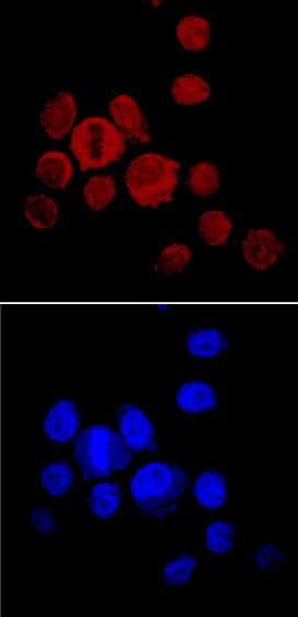 Noggin was detected in immersion fixed PC-3 human prostate cancer cell line using Goat Anti-Mouse Noggin Antigen Affinity-purified Polyclonal Antibody (Catalog # AF719) at 10 µg/mL for 3 hours at room temperature. Cells were stained using the NorthernLights™ 557-conjugated Anti-Goat IgG Secondary Antibody (red, upper panel; Catalog # NL001) and counterstained with DAPI (blue, lower panel). Specific staining was localized to cytoplasm. View our protocol for Fluorescent ICC Staining of Cells on Coverslips.