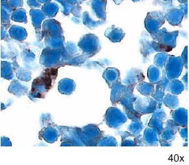 Noggin was detected in immersion fixed frozen sections of embryonic mouse cardiac tissue (11 d.p.c.) using 15 &micro;g/mL Goat Anti-Mouse Noggin Antigen Affinity-purified Polyclonal Antibody (Catalog # AF719) overnight at 4 &deg;C. Tissue was stained with the Anti-Goat HRP-DAB Cell & Tissue Staining Kit (brown; Catalog # CTS008) and counterstained with hematoxylin (blue). View our protocol for Chromogenic IHC Staining of Frozen Tissue Sections.