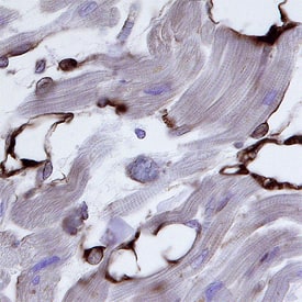 Nogo-B was detected in immersion fixed paraffin-embedded sections of human heart using Human/Mouse Nogo-B Antigen Affinity-purified Polyclonal Antibody (Catalog # AF6034) at 3 µg/mL overnight at 4 °C. Before incubation with the primary antibody, tissue was subjected to heat-induced epitope retrieval using Antigen Retrieval Reagent-Basic (CTS013). Tissue was stained using the Anti-Sheep HRP-DAB Cell & Tissue Staining Kit (brown; CTS019) and counterstained with hematoxylin (blue). Specific staining was localized to endothelial cells. View our protocol for Chromogenic IHC Staining of Paraffin-embedded Tissue Sections.