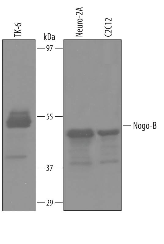 Western blot shows lysates of TK-6 human lymphoblast cell line, Neuro-2A mouse neuroblastoma cell line, and C2C12 mouse myoblast cell line. PVDF Membrane was probed with 1 µg/mL of Human/Mouse Nogo-B Antigen Affinity-purified Polyclonal Antibody (Catalog # AF6034) followed by HRP-conjugated Anti-Sheep IgG Secondary Antibody (HAF016). A specific band was detected for Nogo-B at approximately 49 kDa (as indicated). This experiment was conducted under reducing conditions and using Immunoblot Buffer Group 8.